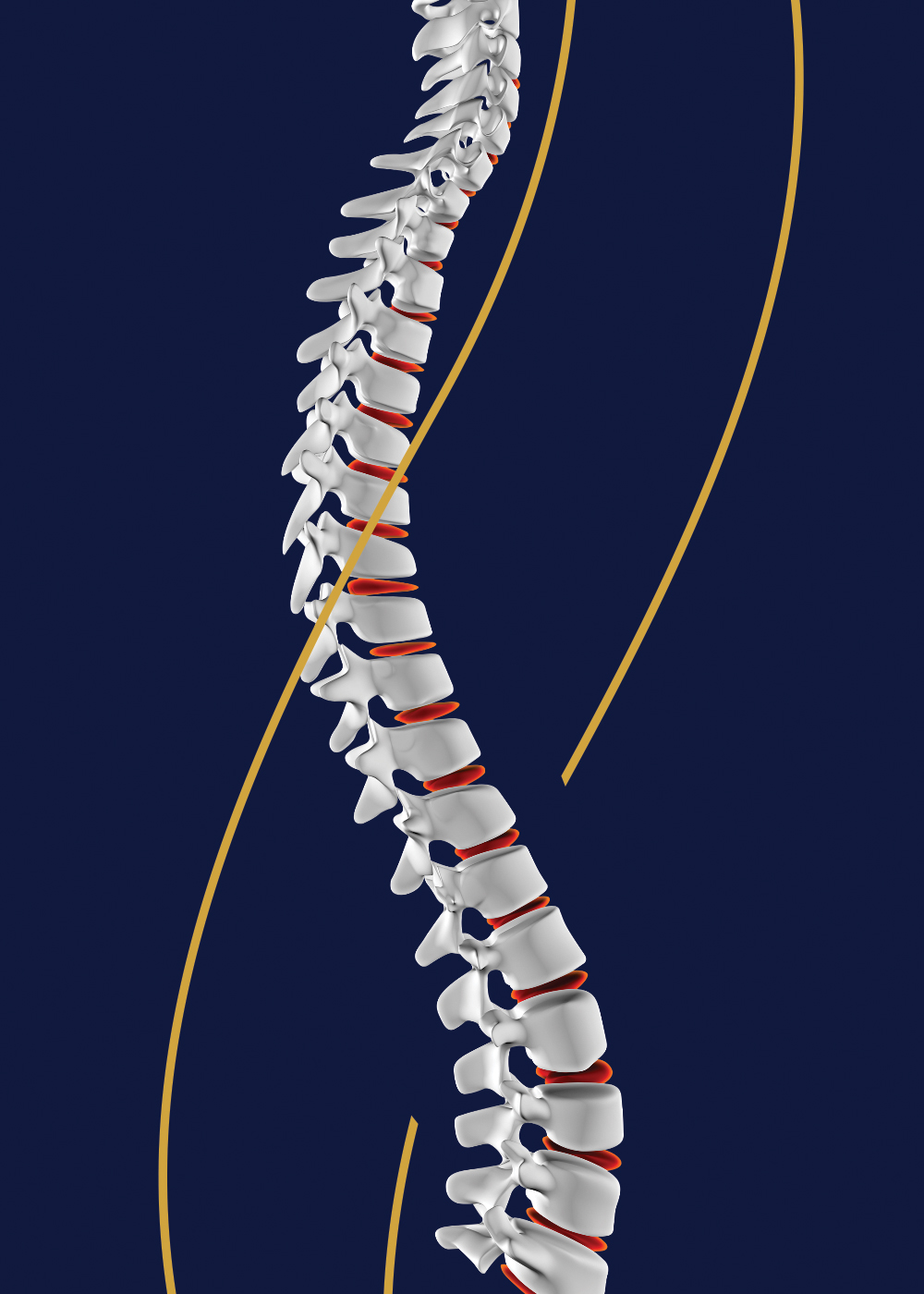 Spine